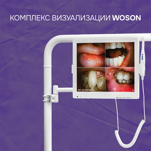 Комплекс визуализации WOSON